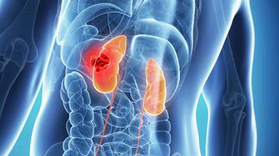 Women and Kidney diseases